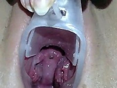 Young girl exploring cervix & deep pussy with speculum